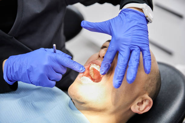 Best Teeth Whitening  in Bagdad, AZ